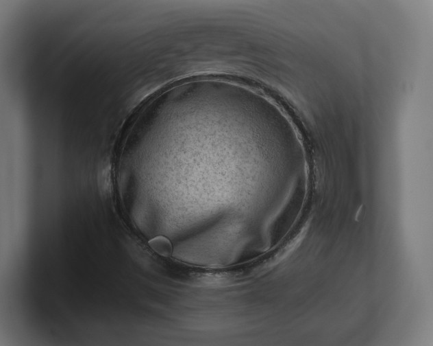 X0000101651497200807171242