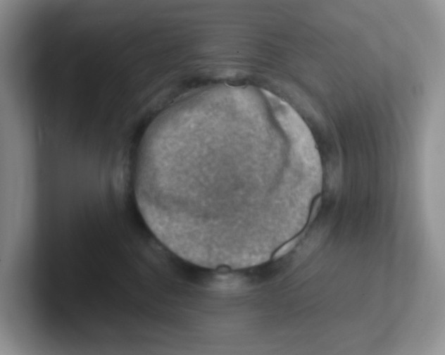 X0000101650376200808071120