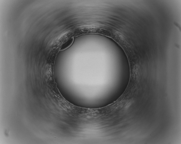 X0000101691062200807171430