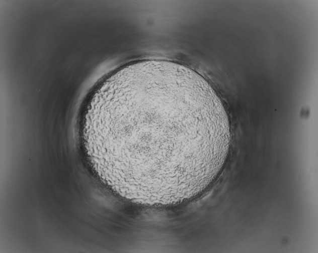 X0000101690343200808071140