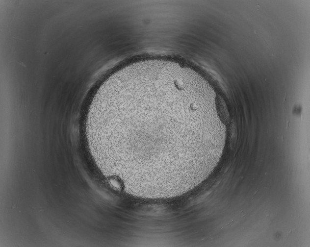 X0000101690492200808071138