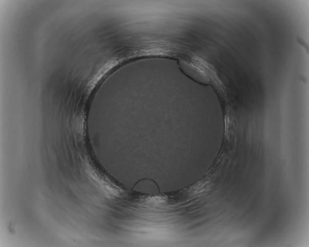 X0000101700156200807101545
