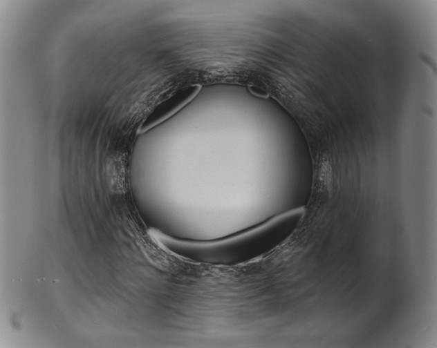 X0000101700868200807101534