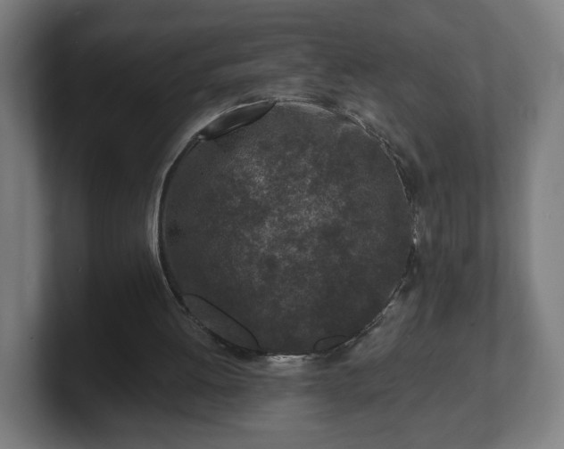 X0000101700052200807171523