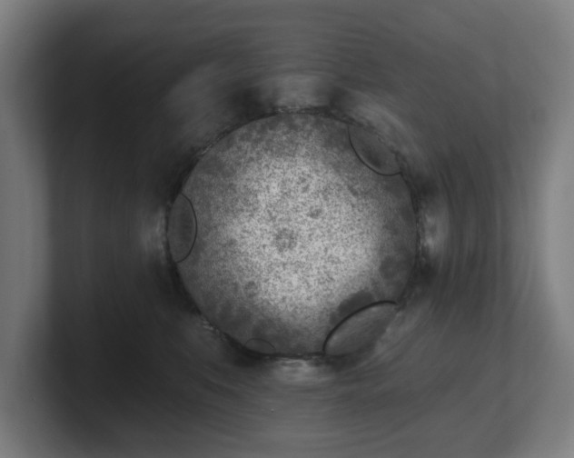 X0000101700519200807171517