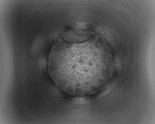 X0000101700523200807171517