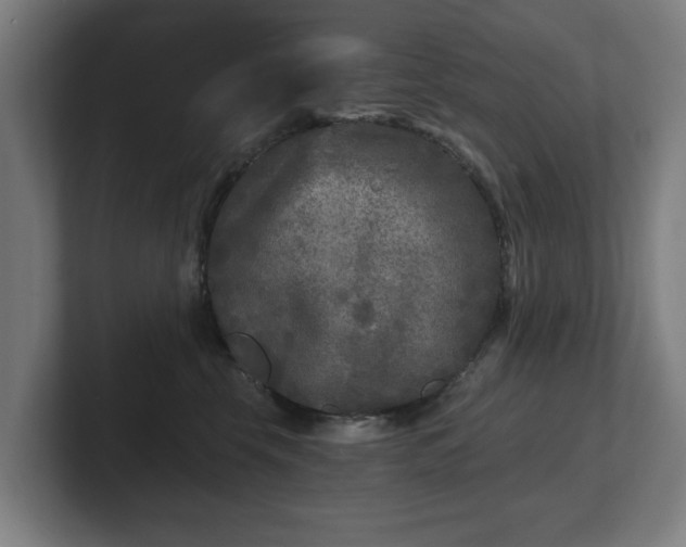 X0000101700569200807171517