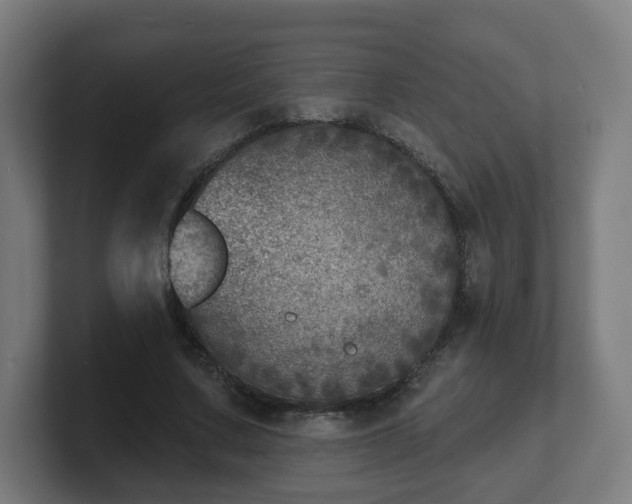 X0000101700683200807171515