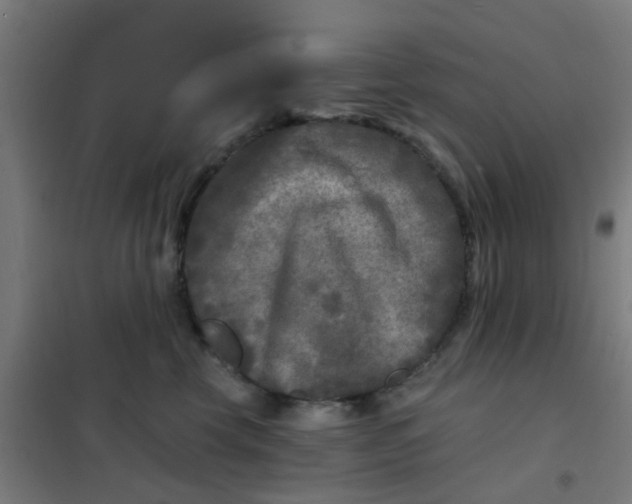 X0000101700569200807241435