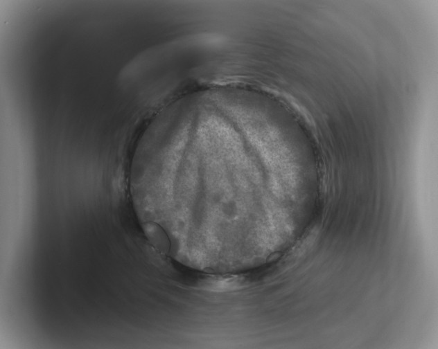 X0000101700569200807311434
