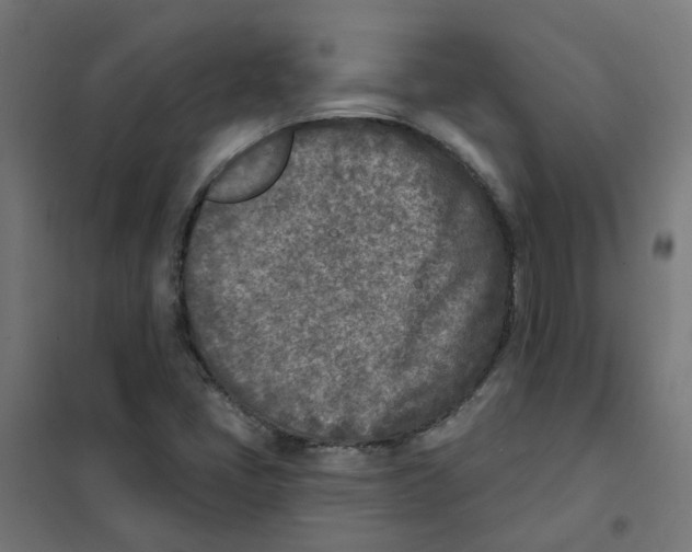 X0000101701405200808071147