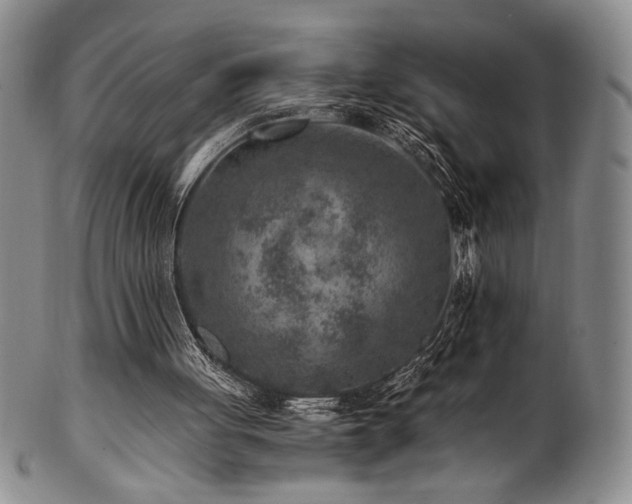 X0000101710051200807101614