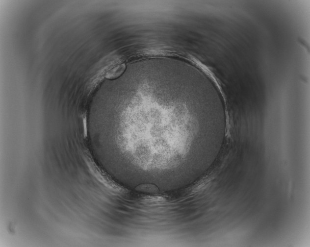 X0000101710061200807101614