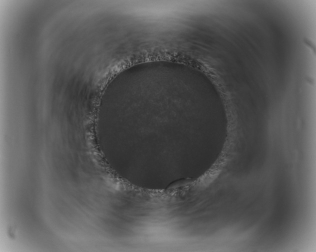 X0000101710192200807101614