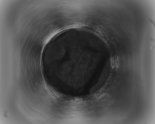 X0000101710196200807101613
