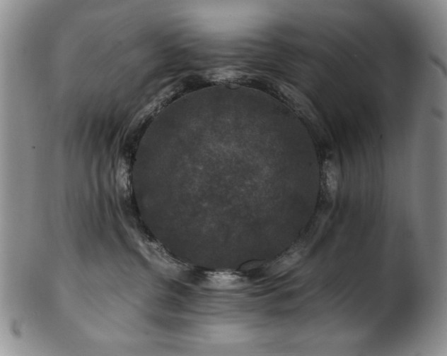 X0000101710380200807101610