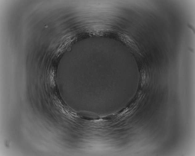 X0000101711060200807101559
