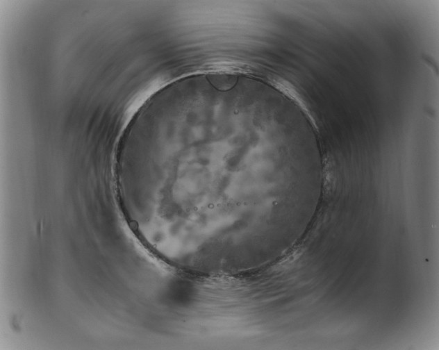X0000101711091200807101559