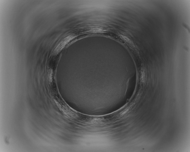 X0000101711161200807101557