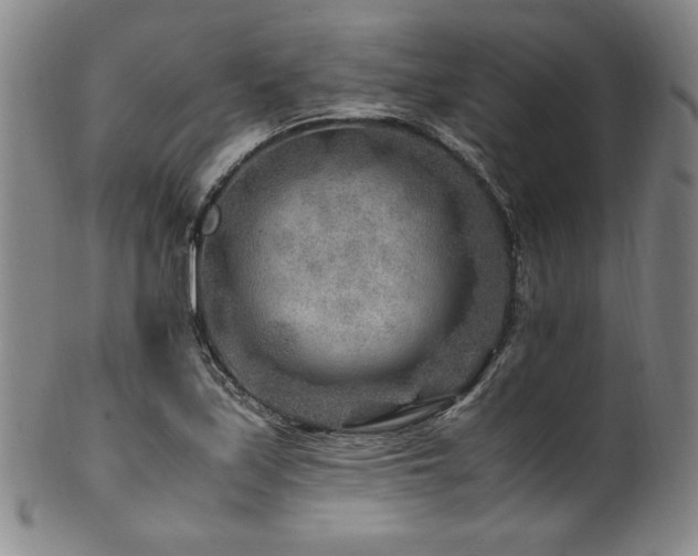 X0000101711171200807101557