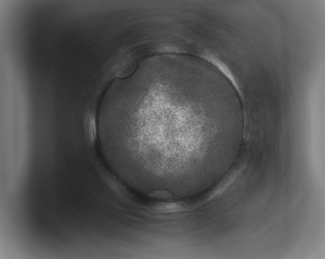 X0000101710061200807171544