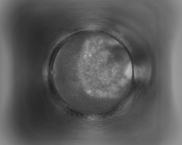 X0000101710579200807171538