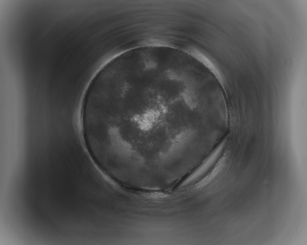 X0000101711141200807171530