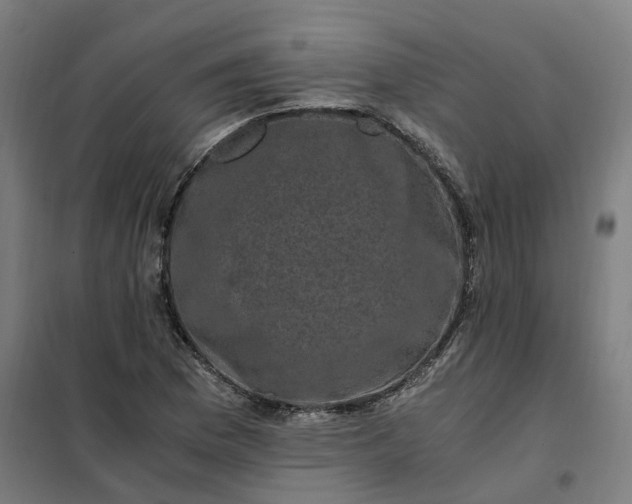 X0000101711169200807241449