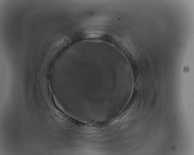 X0000101711441200807241445