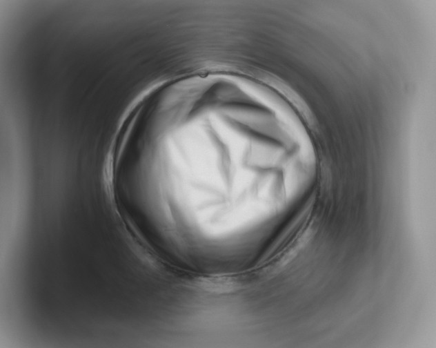 X0000101711198200807311445