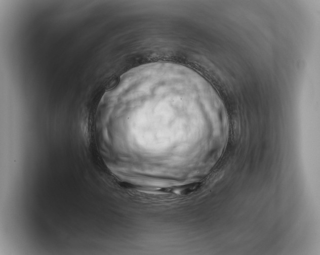 X0000101711250200807311445