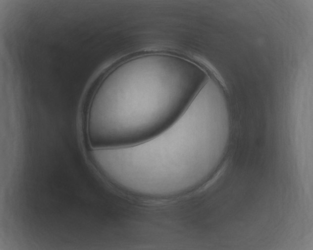 X0000101951122200807180657