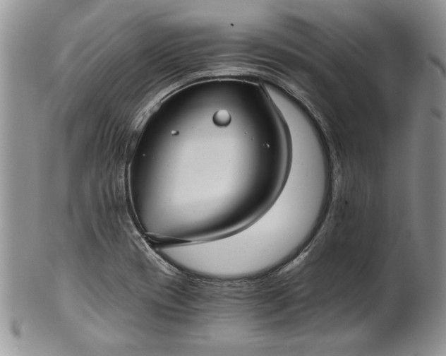 X0000101951417200808011036