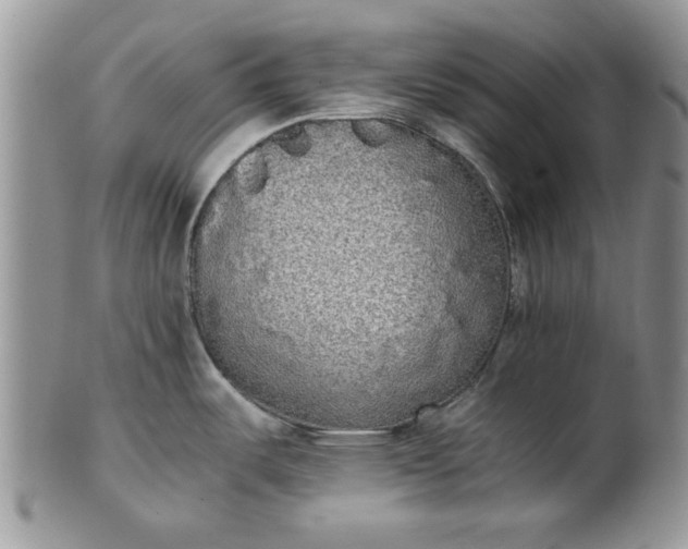 X0000101951487200808011034