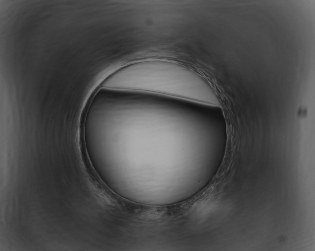 X0000101960148200807180710