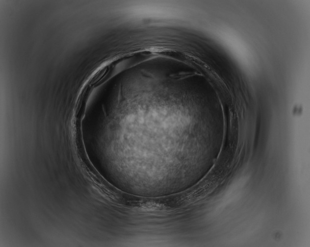 X0000101960387200807181046