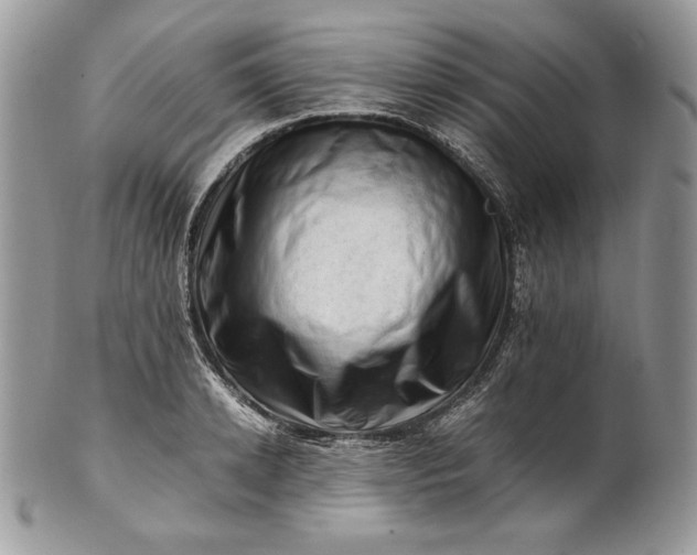 X0000101960942200808011104