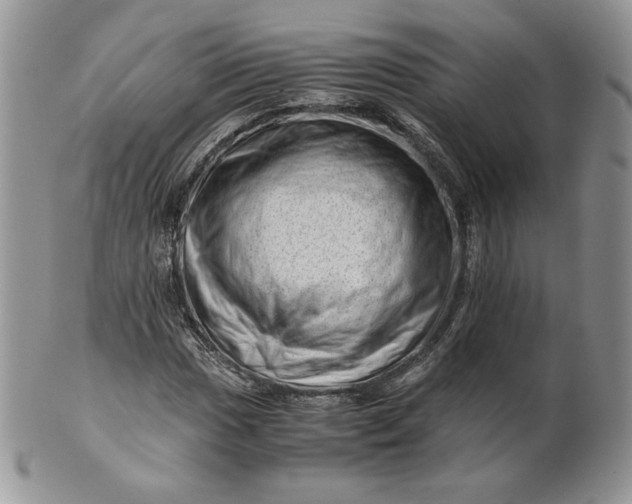 X0000101961017200808011103