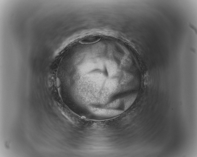 X0000101961496200808011056