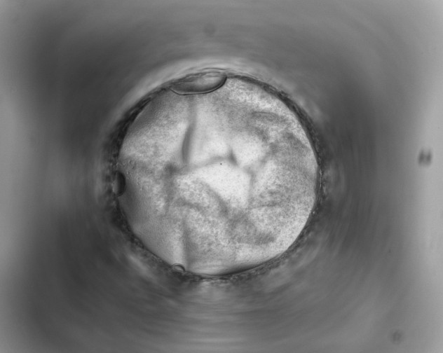 X0000101961496200808151303