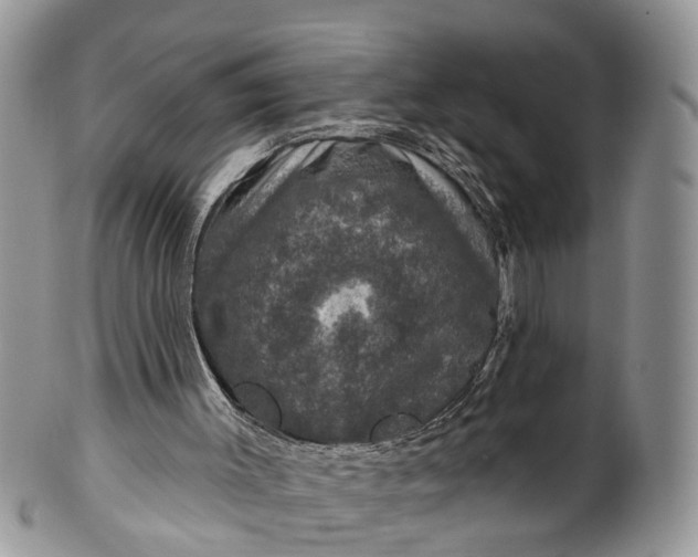 X0000101970003200808011141