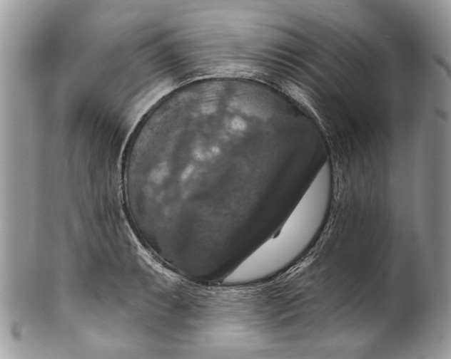 X0000101971087200808011125