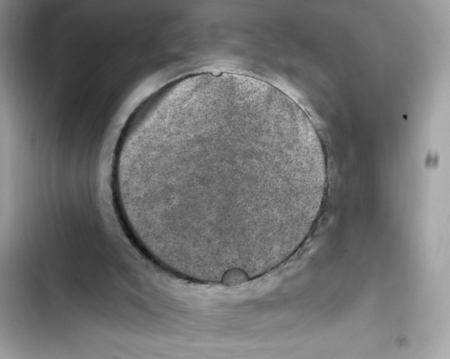 X0000101970007200808151349
