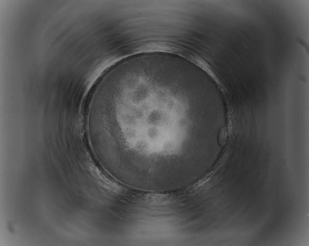 X0000101981116200807181118