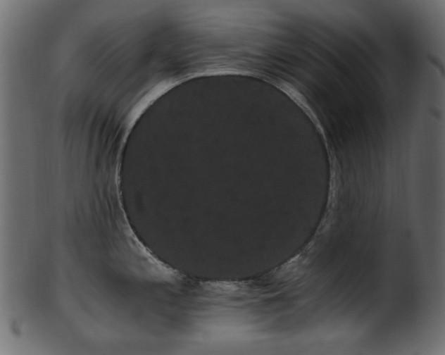 X0000101981197200807181117