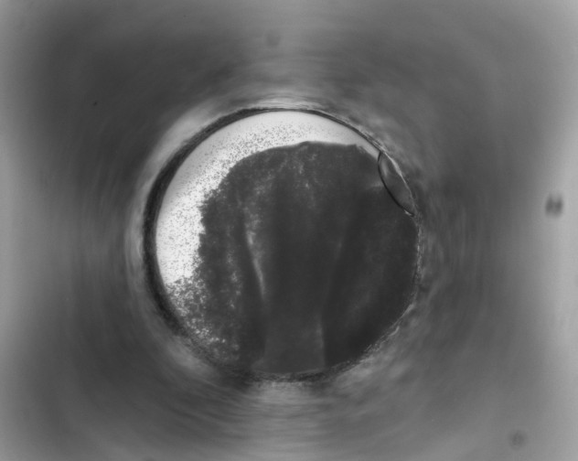 X0000101980296200808151407