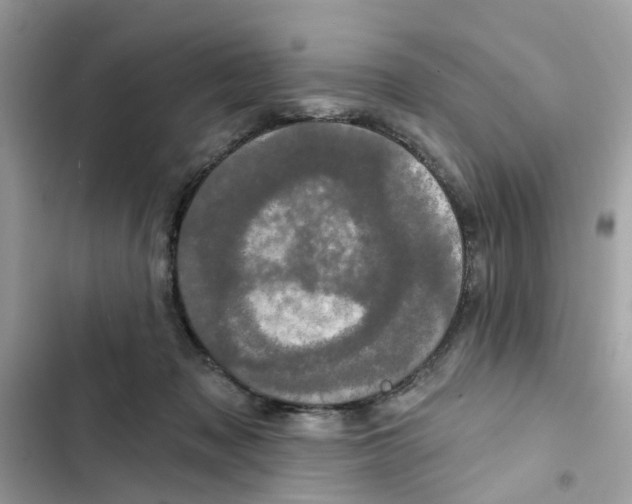 X0000101980317200808151407