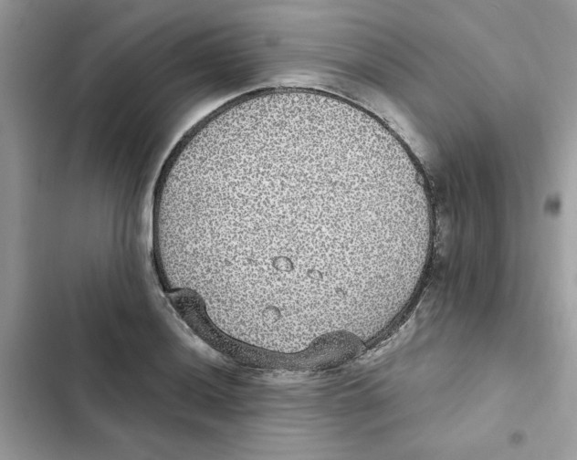 X0000101981036200808151356