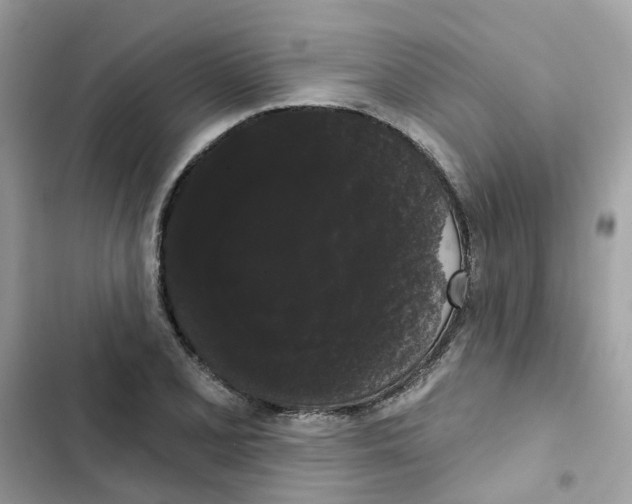 X0000101981077200808151356