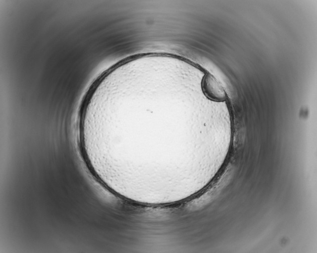 X0000101981080200808151356